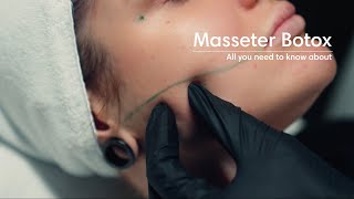 Masseter botox [upl. by Ona]