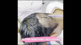 Suture Removing Procedure  Krishna Care Hospital [upl. by Lamond]