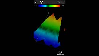 Android Gradiometer Using [upl. by Rufus360]