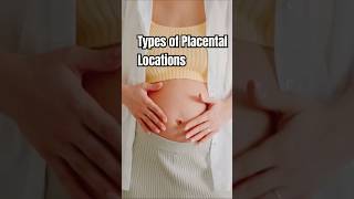 Placental Locations pregnancy placentapositionduringpregnancy [upl. by Akilam515]