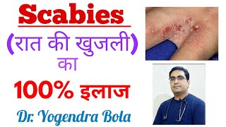 Scabies  ka complete treatment in hindi  scarab scabilice lotion permite 5 vermact 12 mg tab [upl. by Arev28]