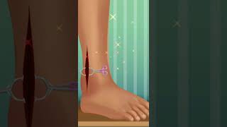 Lets Fix ankle anklepain ankleinjury [upl. by Jacy950]