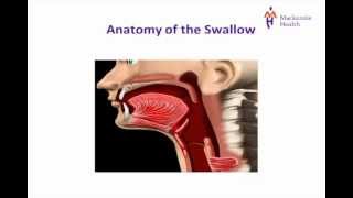 Stroke Education  Dysphagia [upl. by Atinauq]