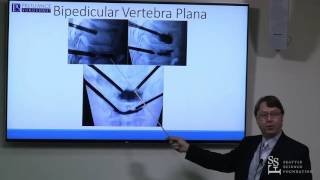 Vertebral Augmentation Pedicular Approach  Neal Shonnard MD [upl. by Setarcos]