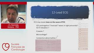 Quel bilan initial pour les extrasystoles ventriculairesjesfc2020 [upl. by Lewiss54]