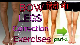 Bow leg को सही करने की एक्सरसाइज हिंदी में। Bow legs Correction Exercises part1 [upl. by Holland481]