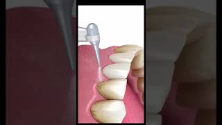 Airflow Teeth Cleaning Animation  Patient Education  Oral Hygiene [upl. by Ehsrop121]