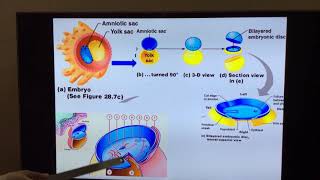 Part I Formation of trilaminar germ disc  Primitive streak [upl. by Anoiuq]