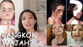 OPERASI PLASTIK CANGKOK WAJAH PALING EKSTRIM DI DUNIA Cindy Thefannie [upl. by Anjela886]