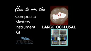 How to Use the Composite Mastery Kit  Large Occlusal [upl. by Indihar990]