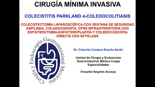 Colecistitis Parkland 4 Colecistectomía Laparoscópica Ventana de Seguridad Ampliada CPRESpyglass [upl. by Beacham]