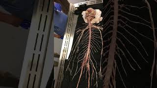 Nervous system shorts  nerves in human body shortsNervous system modal shorts [upl. by Ixela]