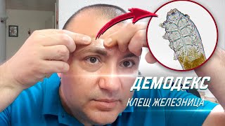 Мелкий паразит живет в коже каждого человека  Угревая Железница Demodex [upl. by Richman]