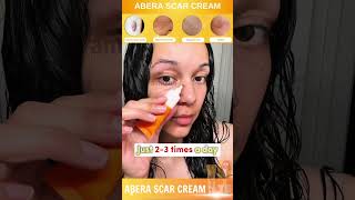 Does Abera Really Help Regenerate Damaged Skin scarcream damagedskinrepair Abera [upl. by Asa]