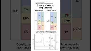 Obesity effects on lung volumes [upl. by Seavey705]