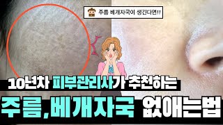 모든피부타입의 속건조증상을간단히해결할수있는방법 amp피부속까지촉촉해지는간단한홈케어방법 10년차 백화점 amp 피부과 피부관리사추천템 광고X [upl. by Yorker]