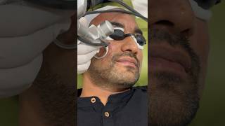 Best Laser treatment for your face [upl. by Rap388]