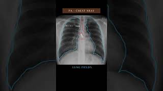 Chest Xray  PA view anatomy trendingshorts medical viralvideo reels shorts doctor [upl. by Dianne]