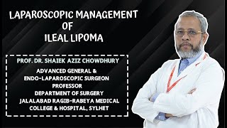 Laparoscopic management of Ileal lipoma [upl. by Adli448]