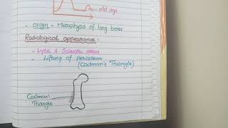 Osteosarcoma Pathology [upl. by Robbi]