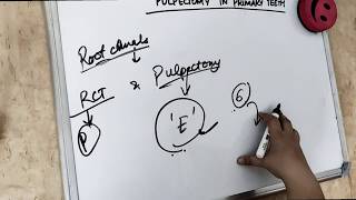 pulpectomy procedure in primary teeth special rct [upl. by Hanad]