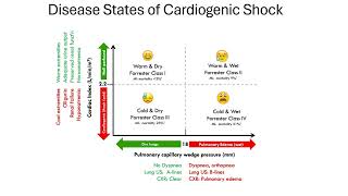 cardiogenic shock [upl. by Blatt174]