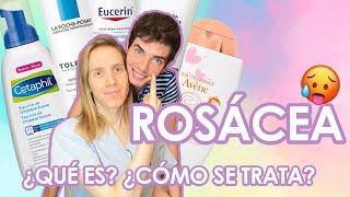 ¿Qué es la ROSACEA ¿Cómo se trata  Productos que recomiendo [upl. by Einhpad]