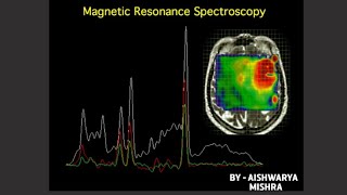 MRS Magnetic Resonance Spectroscopy BY RADIATION TECHNOLOGY [upl. by Lyrem]