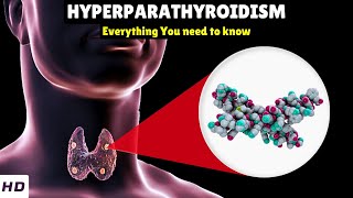 Hyperparathyroidism – Types Causes Signs and Symptoms Diagnosis amp Treatment [upl. by Ayekahs285]