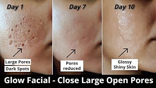 4 Step Glow Facial  Close Large OPEN PORES Remove DARK SPOTS amp get Glowing Skin  Aloevera icecube [upl. by Warring634]