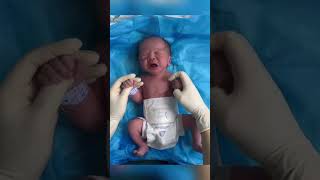 The nurse helped the newborn check his body The newborns small body is very cute [upl. by Bernardina]