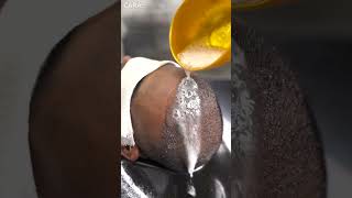 Expert Tips for First Shampoo After Hair Transplant  Cara Clinic [upl. by Siulegroj]