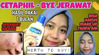 REVIEW CETAPHIL GENTLE SKIN CLEANSER  CARA MENGHILANGKAN JERAWAT amp BRUNTUSAN by Khairunnisa Adlina [upl. by Anayd]