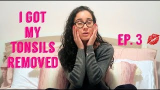 I GOT MY TONSILS REMOVED AT 21 TIPS amp RECOVERY VLOG2019 [upl. by Divan]