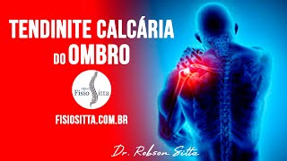 DOR no OMBRO TENDINITE CALCÁRIA CAUSAS e TRATAMENTO de FISIOTERAPIA  Fisioterapia Dr Robson Sitta [upl. by Dor]