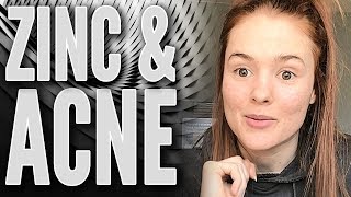 Why Everyone With Acne Should Try Zinc  Natural Treatment for Acne [upl. by Garnett782]