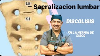 Sacralizacion Lumbosacra y Protrusiones de disco [upl. by Airalav]