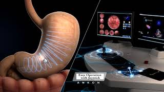 Capsule Endoscopy Animation  ANKON NaviCam [upl. by Kin]