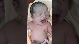 Newborn baby Cry immediately after Birth  Happiest moment for a mother shorts baby [upl. by Asiral21]