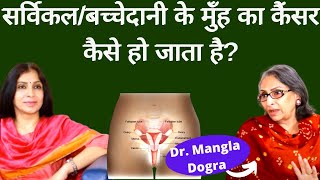 Cervical Cancerबच्चेदानी के मुँह के कैंसर के बारे में पूरी जानकारी कैसे होता है कैसे बच सकते हैं [upl. by Ruamaj]