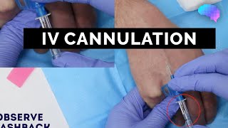 Intravenous IV cannulation  OSCE Guide  UKMLA  CPSA [upl. by Dibrin]