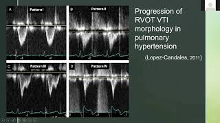 Evaluating RVOT Right Ventricular Outflow Tract With Ultrasound and Doppler [upl. by Mushro]