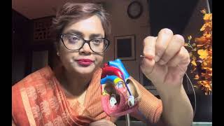 Ventricular septal defect  VSD device  HINDI 9830769550 [upl. by Bergeron]