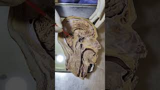 CEREBRO SPINAL FLUID  CIRCULATION  csf shorts anatomy shortsyoutubeindia shortsyoutube [upl. by Atrice]