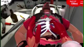 Surgeon Simulator 2013 WITH RAZER HYDRA A [upl. by Nyladnek]