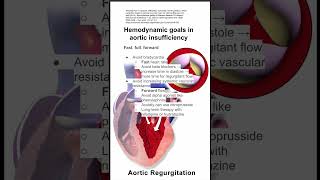 Hemodynamic goals in aortic insufficiency [upl. by Sackman]