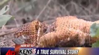 Texas Man Stung by More Than 1200 Bees [upl. by Glanti]