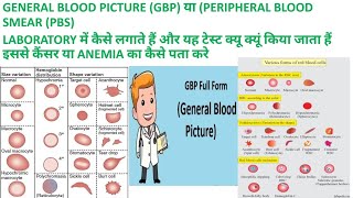 CBC SE GBP या PBS GENERAL BLOOD PICTURE or PERIPHERAL BLOOD SMEAR KI REPORT KAISE BANAYE [upl. by Ansel]