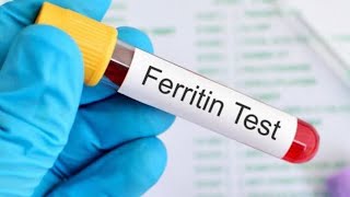 Ferritin test [upl. by Hnah]