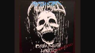 Mutilated  Hysterical Corpse Dislocation [upl. by Eehc180]